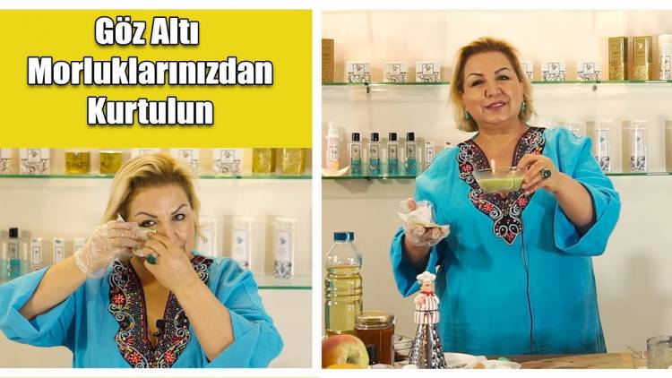 Göz Altı Morluklarından Kurtulmak İçin iki Muhteşem Tarif