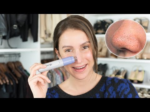 SİYAH NOKTALARA KESİN ÇÖZÜM!!! Vakumlu Gözenek Temizleyici Denedim | Ürün İnceleme