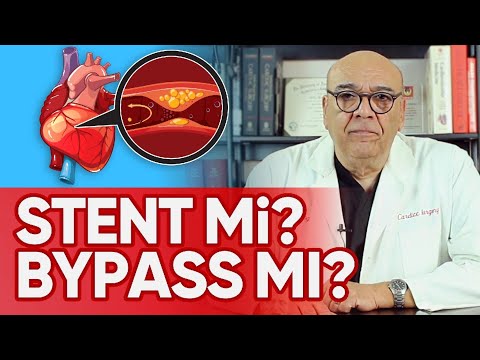 STENT Mİ BYPASS MI? – (Stent İşlemi Faydasız mı?) / 5 Dakikada Sağlık