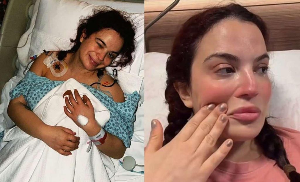 Aslı Bekiroğlu'dan Zorlu Sağlık Mücadelesi Açıklaması: 7 Ameliyat Sonrası Yaşadığı Süreçler Ortaya Çıktı