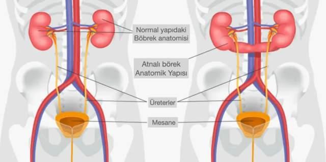 At Nalı Böbrek Nedir? Prof. Dr. Ramazan Gökhan Atış Uyarısı: Bilinmesi Gerekenler