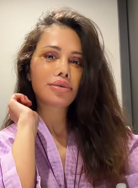 Didem Ceran'dan Sert Yanıt: Kore'deki Yüz Nakli Ameliyatı Sonrası Gelen Eleştirilere Tepkisi