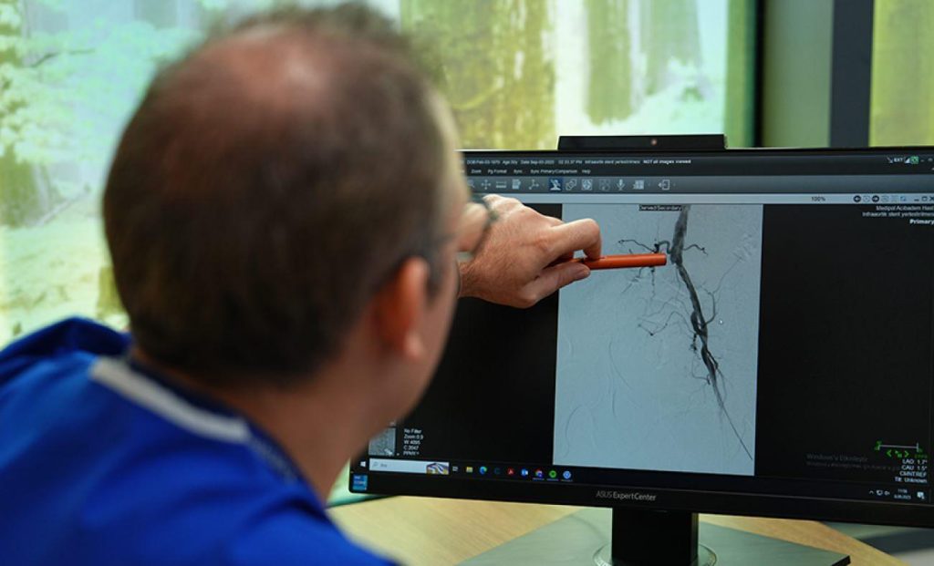 Kangren Nedir? Uzuv Kaybı Riskini Artıran Damar Tıkanıklığı Belirtileri ve Önlemleri