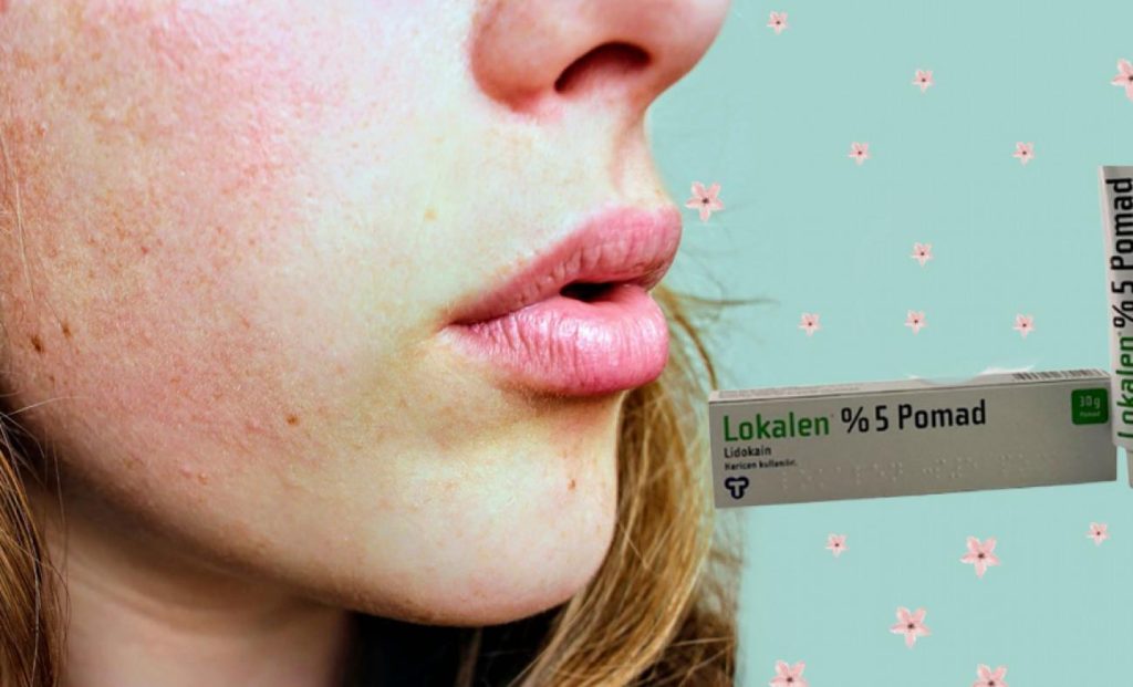 Lokalen Pomat Nedir? Lidokain İçeren Bu Krem Nasıl Kullanılır ve Faydaları Nelerdir?
