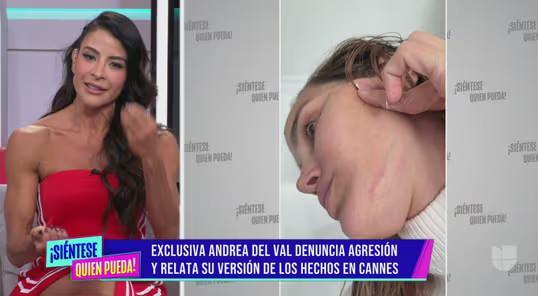 Miss Venezuela Andrea del Val'dan Cannes Film Festivali Otel Odasında Yaşadığı Korkunç Saldırıyı Anlattı