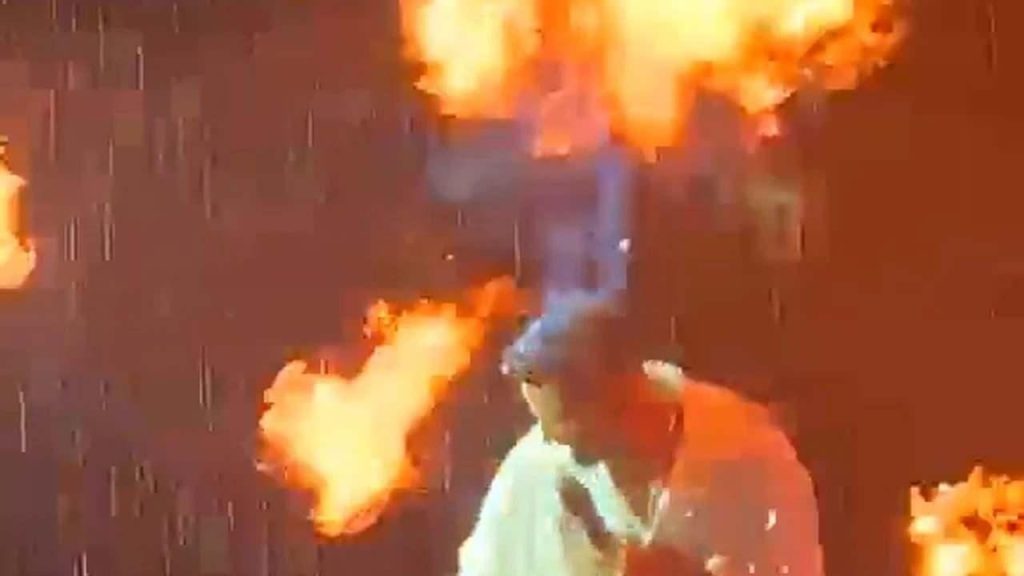 Tan Taşçı Konserde Yüzünü Yanıttı: Sahne Efekti Alevleri Arasında Kaldığı Anlar Sosyal Medyayı Salladı