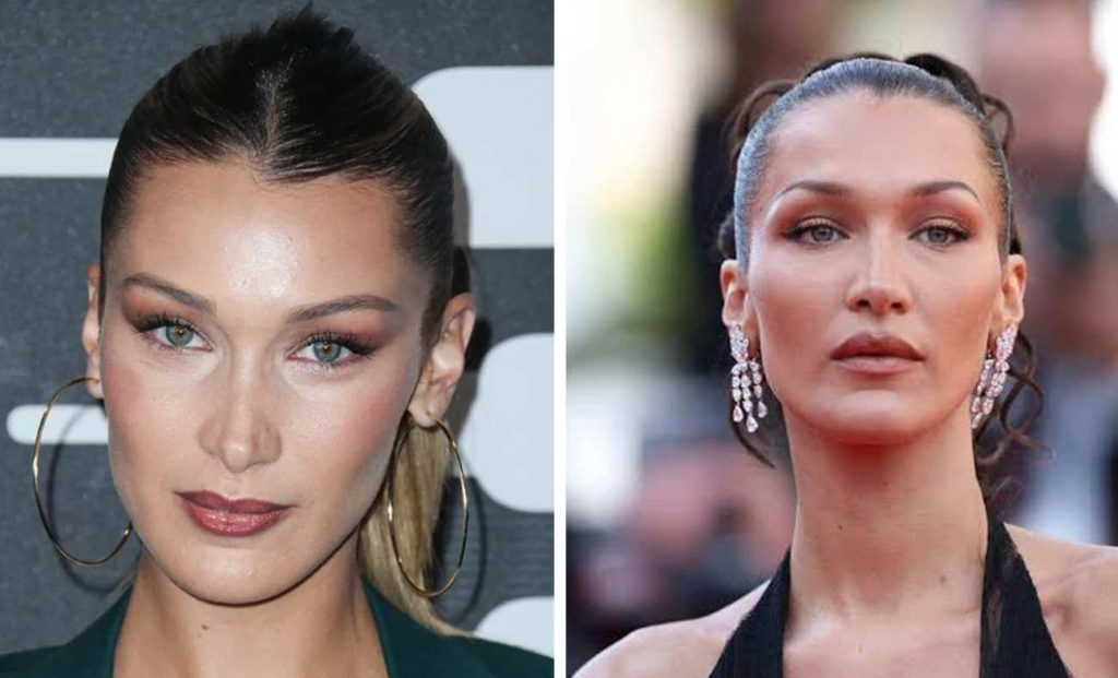 Bella Hadid Lyme Hastalığının Yeniden Alevlendiğini Gözyaşlarıyla Duyurdu