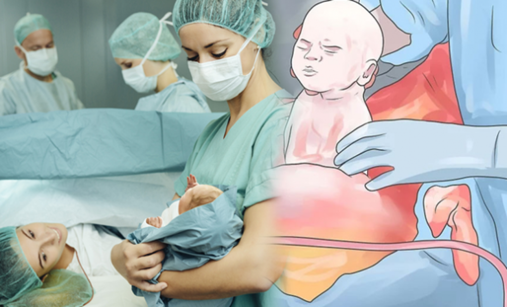 Sezaryen Doğum Nedir? Normal ve Zorunlu Sezaryen Süreci Hakkında Bilmeniz Gerekenler