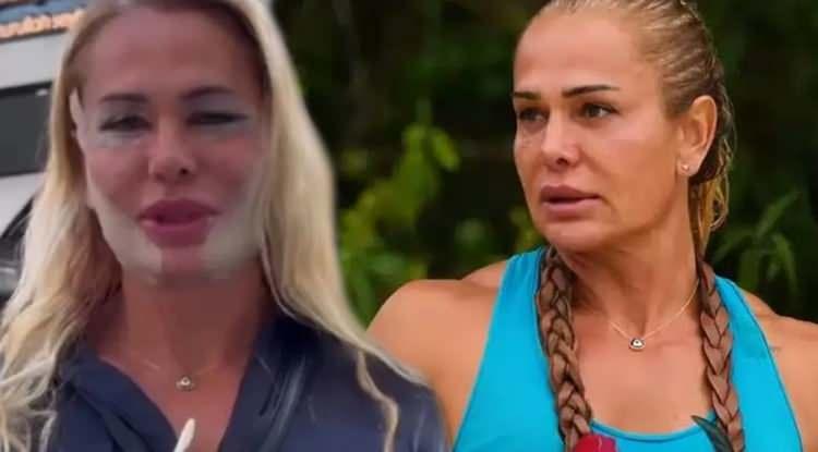Survivor Yıldızı Nagihan Karadere Türkiye’ye Döner Dönmez Estetik Ameliyatı Oldu